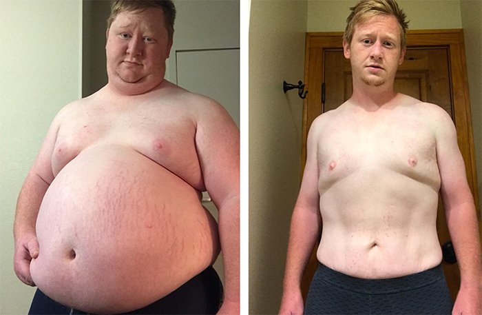 comparison images man weight loss