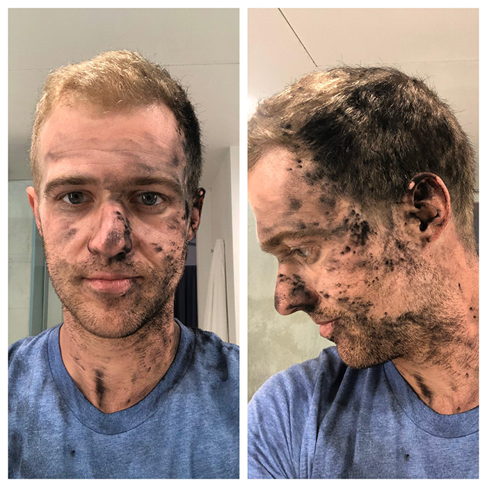 printer ink all over man's face
